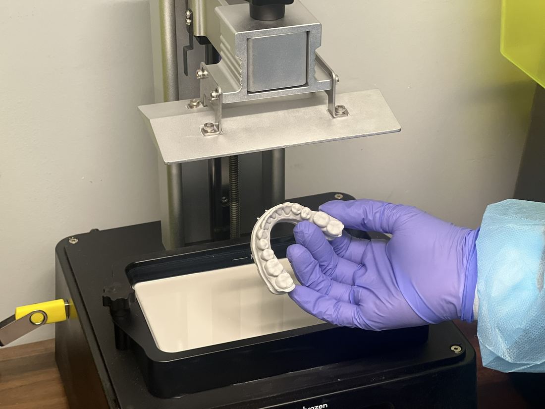 Digital dental model made from an intraoral scan at South Bay Dental Arts